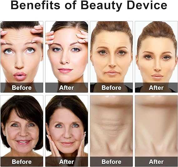 Eye beauty device